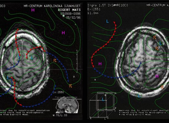 B&B MRI Self Portrait with Synoptic Weather Maps_1962_1965_1996_2022.